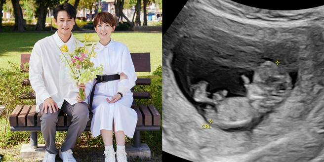 孙可芳和刘冠廷迎来爱的结晶，右为宝宝超音波照。（摘自孙可芳脸书）