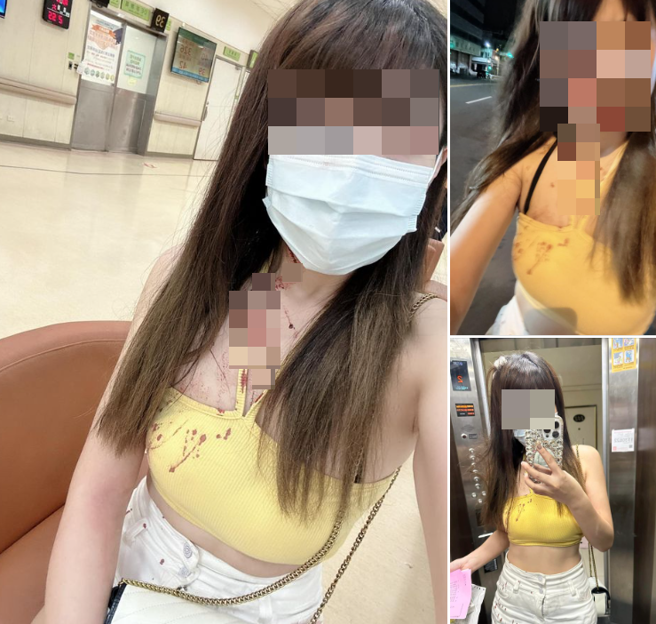 一名32岁刘姓女子今于脸书爆料公社发文控诉，称她前日至台中市中区自由路二段一间酒吧时，横遭店内小姐围打痛殴。（图 / 翻摄自爆料公社）
