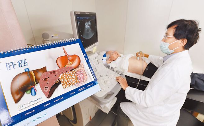 肝癌约8成由C、B肝引起，若前期能照顾好，就可避免进入肝硬化、肝癌的「肝病三部曲」。（本报资料照片）