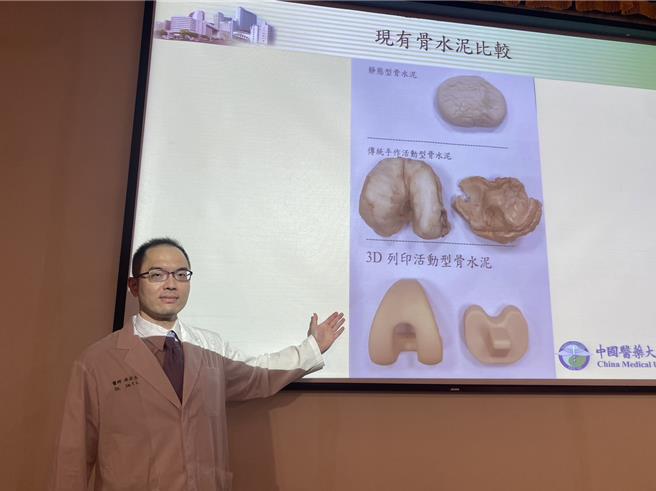 中国附医骨科部人工关节科医师林宗立说，与过去静态型骨水泥相较置入活动型骨水泥的膝关节活动角度大，可减少关节挛缩及肌肉萎缩，利于第2阶段重建手术。（冯惠宜摄）