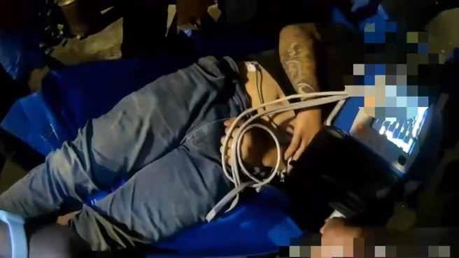 朱嫌头部遭重击挫伤，一度失去意识，经员警到场施以心肺復甦术后，始恢復生命迹象。（翻摄画面）