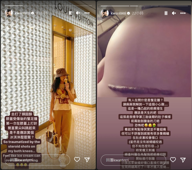 关颖透露不久前下飞机重摔后的状况，还加码晒出剖腹产的刀疤照，有超严重的蟹足肿。（图／摘自关颖Instagram）
