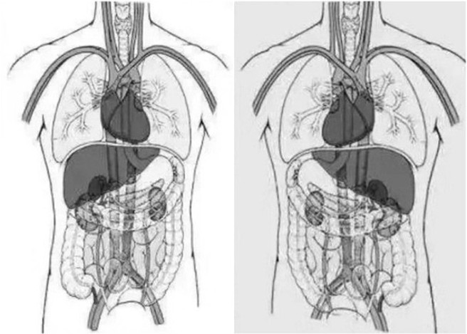 在中国取消新冠清零政策后，今年前7个月通过超音波确诊的胎儿内臟逆位病例（右）发生率，是过往8年平均年发病率的4倍多。（图／东网）

