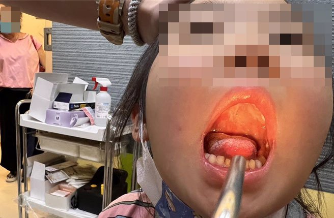 天气转凉，台中肠病毒疫情仍未退烧，基层诊所仍可见因肠病毒就医的小病患台中市肠病毒门诊人次每周仍逾千人。（冯惠宜摄）