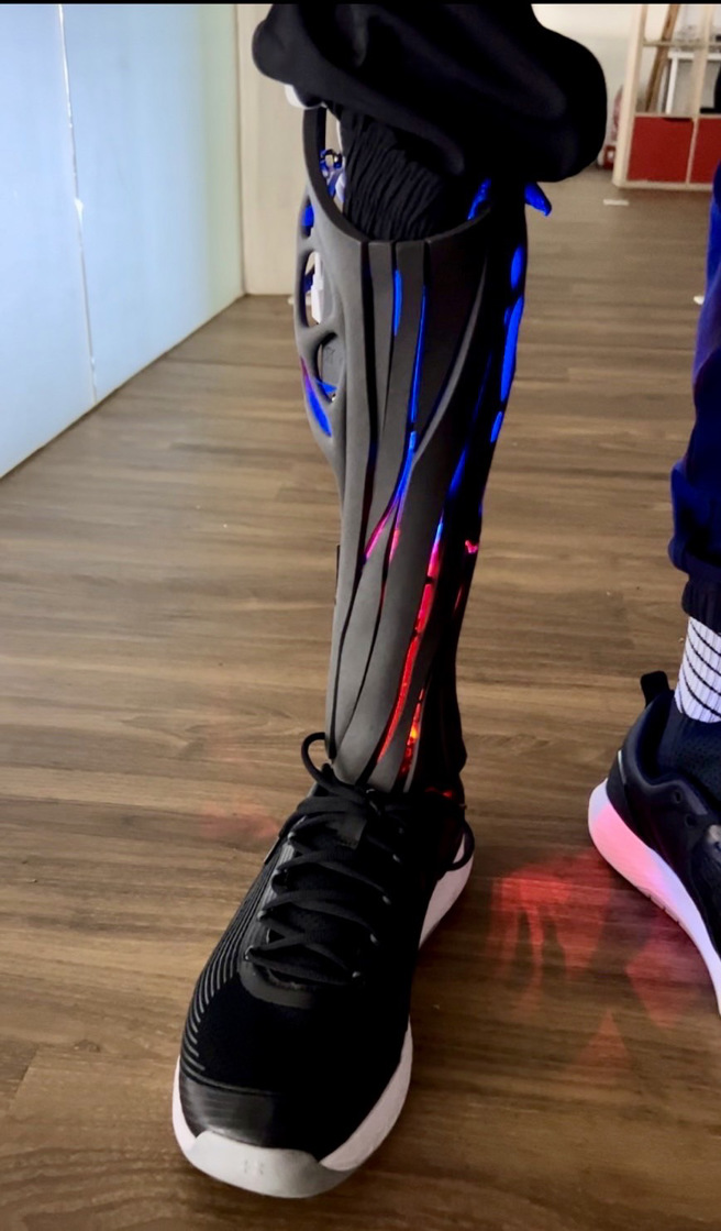 义肢外壳让林立杰相当满意，费用也由大同大学全额赞助。（大同大学提供）