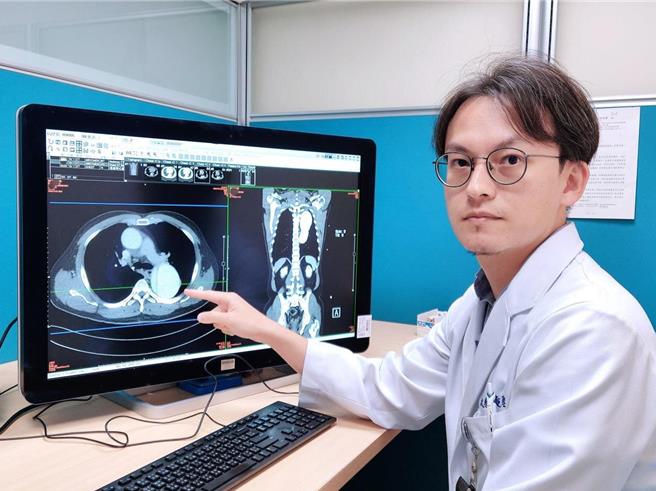 放射诊断科黄竣圣医师指出降主动脉剥离影像。（丰原医院提供）