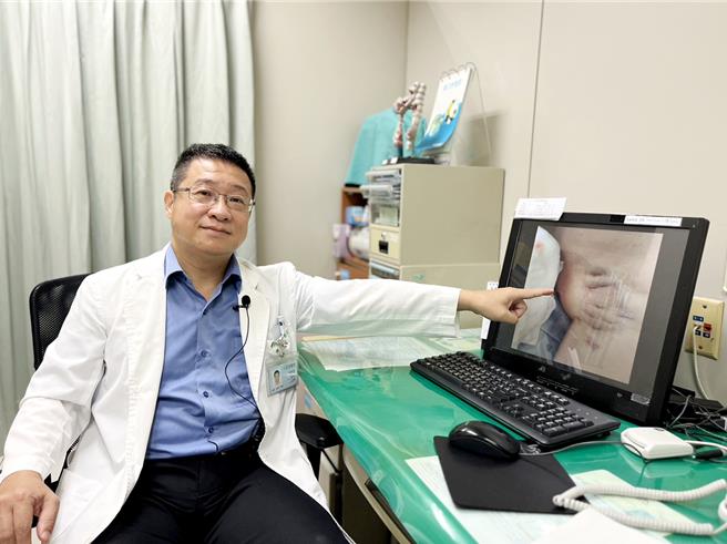 澄清医院整形外科医师蔡秉衡表示，腋下出汗狐臭，是皮肤下顶浆腺的问题，清除顶浆腺不再狐臭，也不会发生代偿性出汗的后遗症。（澄清医院提供／冯惠宜台中传真）