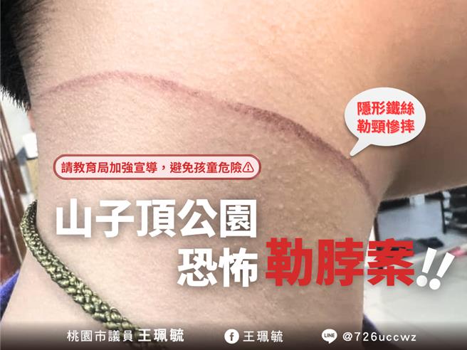 2男童公園玩鐵絲，同學騎車險遭割喉急送醫。(王珮毓提供／蔡依珍桃園傳真)