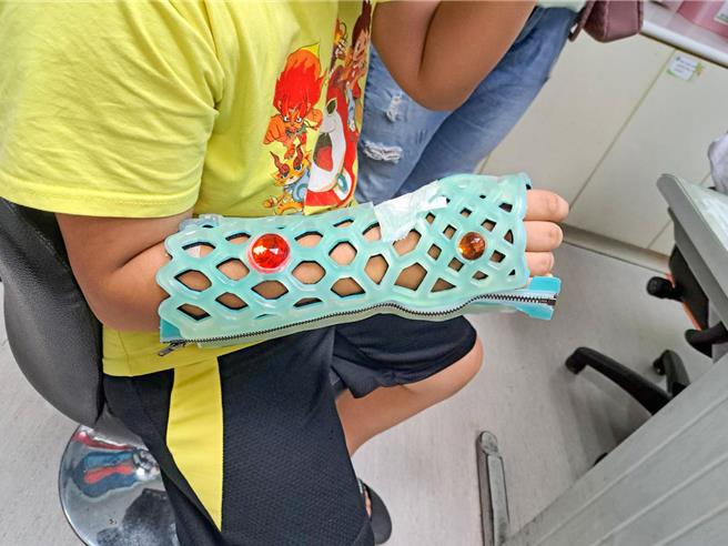 9岁男童玩耍不慎跌倒造成右手桡骨骨折，经过手术治疗后3个月已经可以恢復日常活动。南投基督教医院提供