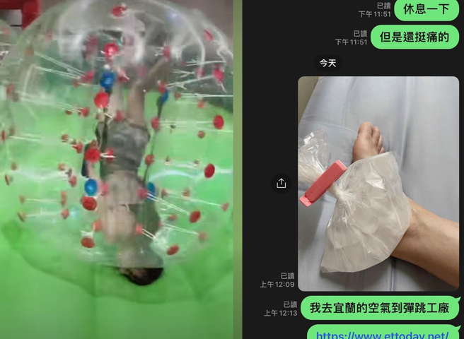  胡文英到玩泡泡足球扭伤脚。（图／胡文英 FB）