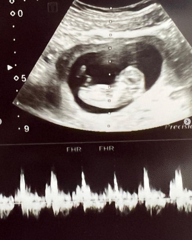 罗雯晒超音波照。（图/tiffanywenlo IG）