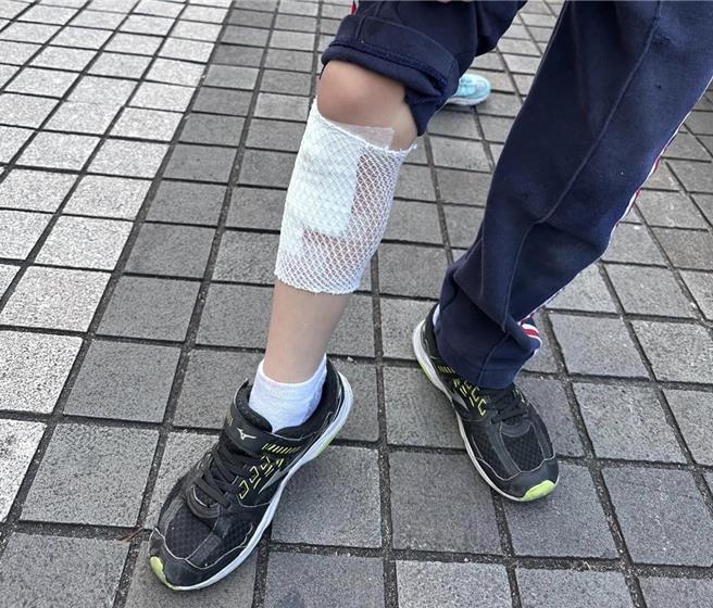 台北市议员许淑华指出，台北敦化国小活动中心因设备老旧没钱整修，导致学童摔倒膝盖撕裂伤，缝了3针。（许淑华提供）
