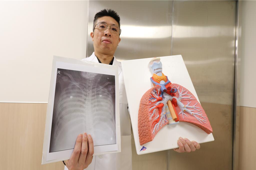 亞洲大學附屬醫院心臟外科主任劉殷佐指出，患者病危時肺部因嚴重感染，連X光都看不到正常肺臟。（亞大醫院提供／潘虹恩台中傳真）