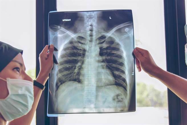 肺癌是台湾死亡率第一的癌症（非当事人/图片来源：pixabay）