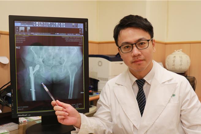 台中慈濟醫院骨科醫師陳明慶說，「微創骨髓內釘固定復位」比較傳統打鋼板傷口更小，骨折癒合速度也更快，只要條件符合，健保開放有差額給付。（慈濟醫院提供／張妍溱台中傳真）