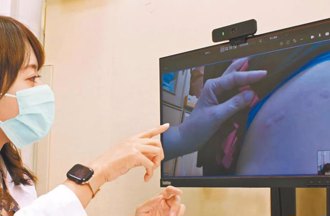 面對面的溫暖無法取代 醫籲《數位醫療發展條例》限縮適用對象