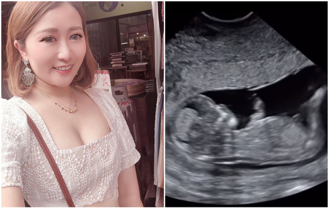 白馨儒宣布怀孕。（图／FB@白馨儒(白白)）