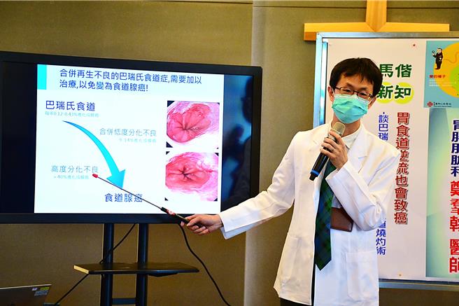 巴瑞氏食道为癌前病变，当合併低度分化不良时，每年有9％至14％的机会发展为食道腺癌；进展成高度分化不良，则有超过40％的机会变成癌症。（台东马偕医院提供／萧嘉蕙台东传真）