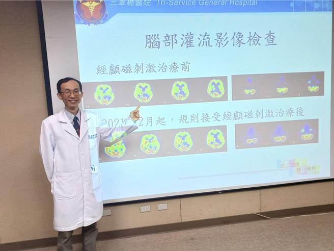 三军总医院復健科医师张正强说明，临床上约有4成脑中风患者合併肢体痉挛，注射肉毒杆菌合併重复经颅磁刺激（rTMS），可帮助活动能力可恢復7到8成。（王家瑜摄）