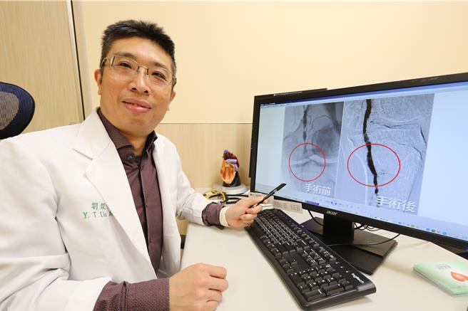 亚洲大学附属医院心臟外科主任刘殷佐提醒，高风险族群如年长者、三高或有抽菸习惯者，一旦出现下肢「疼痛跛行」、「冰冷」以及「肤色苍白或发紫」等情形，都应尽快安排检查。（亚大医院提供／潘虹恩台中传真）