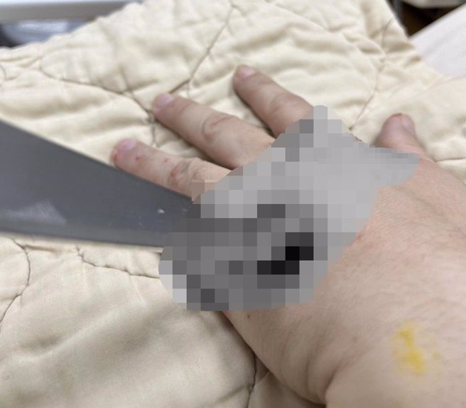 新店区某印刷公司40多岁的男性员工29日中午12时，操作机台不慎被1根金属条刺中左手掌。（新北消防局提供）