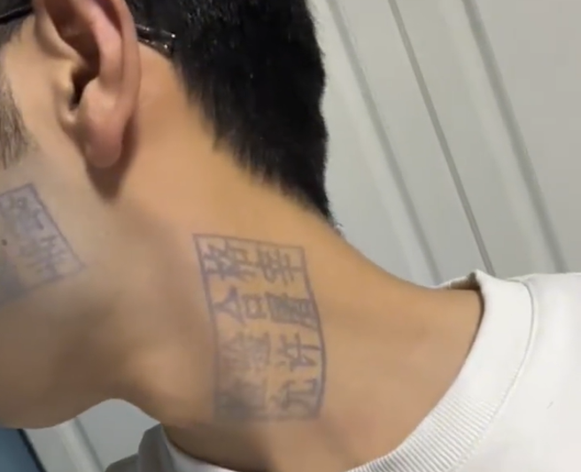 男子因和朋友玩游戏输了，遭用「猪肉印章」盖上，两天过后，印记仍洗不掉。（图／翻摄自微博）