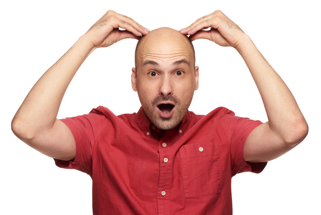禿頭對外表影響程度不小，很多人為此困擾不已。（示意圖／Shutterstock）