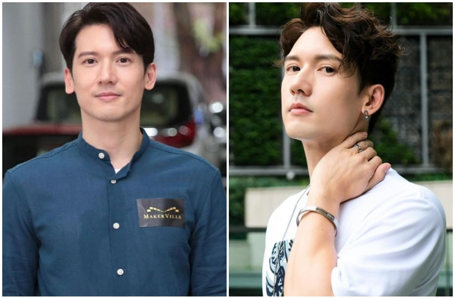 关智斌由于住处瓦斯漏气不慎点火，导致脸部及手部二度烧伤。（图／kennyjr IG）