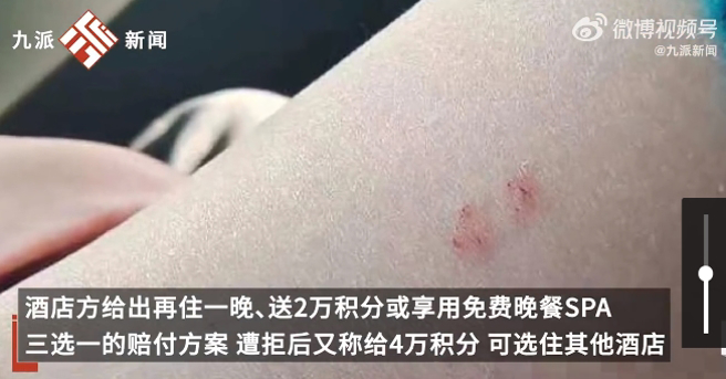 男網友PO出被蛇咬的傷口。（翻攝九派新聞）