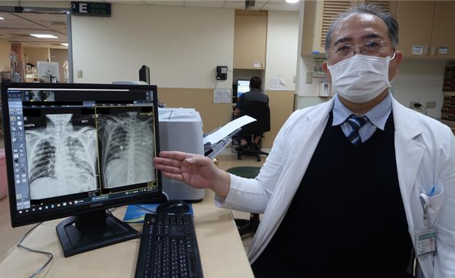 鄭恩宗主任表示，發生肺炎時會影響肺部供給血氧，導致身體無法正常運作。（大千醫院提供／李京昇苗栗傳真）
