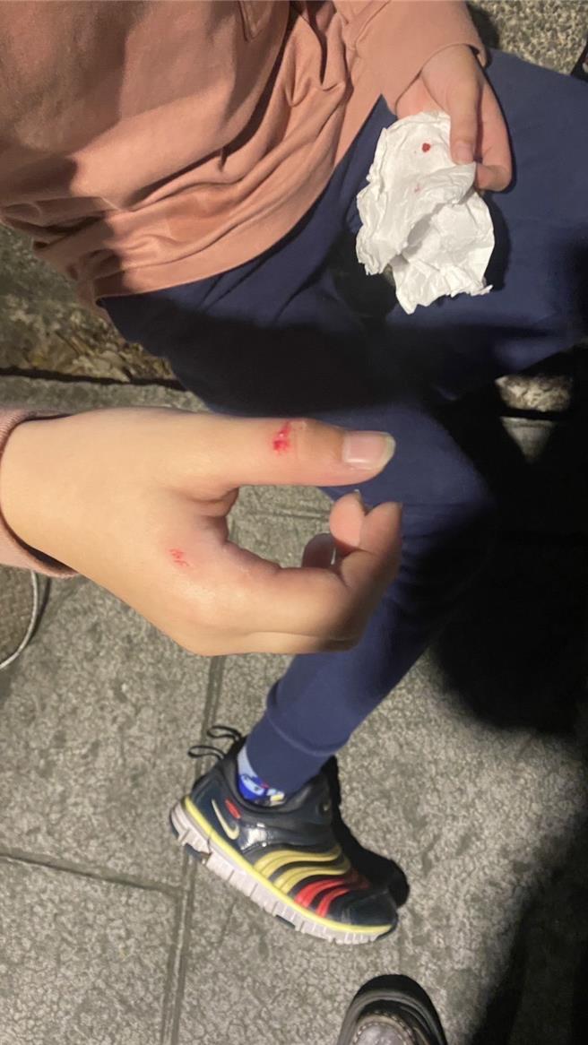 多名孩童在基隆市永平公園玩滑梯時，被扶手上的防滑貼條擦傷。（基隆市政府提供／張志康基隆傳真）