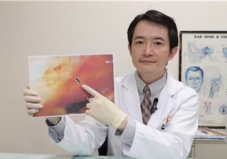 流鼻血是警訊！婦頭暈10多年驚罹罕病 醫：長期有3症狀要注意