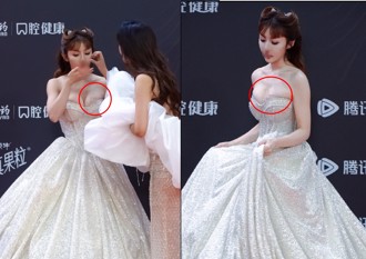 女星走紅毯2次跌摔「鼻血滴乳」 網驚呼：以為是假裝的