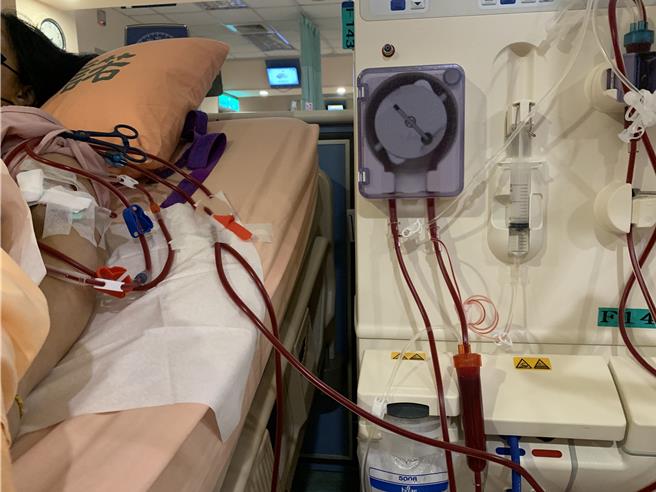 花蓮40歲潘姓婦女洗腎5年，相隔12年再度懷上第二胎，經醫療團隊改變、調整療程與用藥，成功幫助她在7月底順利產下女兒，且寶寶至今健康長大。（門諾醫院提供／羅亦晽花蓮傳真）