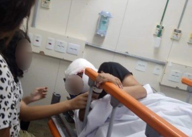 17歲巴西少女在卡丁車比賽中因頭髮被捲入引擎，導致80%的頭皮被活活剝下。（圖／翻攝自X）  