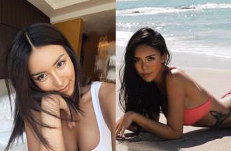 超辣女模消失2個月左手沒了 現身驚曝：我截肢了