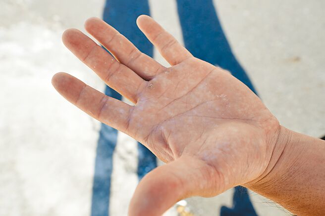 简士凯掌心的茧因渔作生成。（杨婷雅摄）