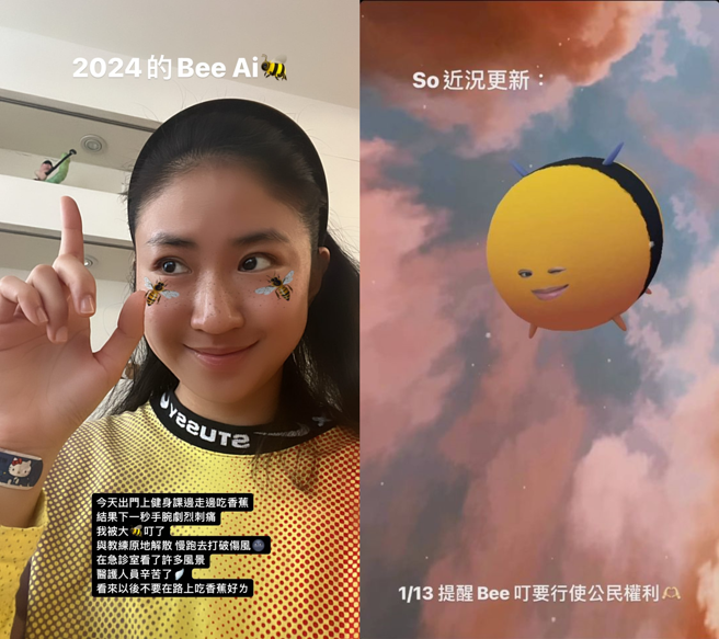 9m88自曝邊走邊吃香蕉，突然手腕劇烈刺痛。(圖／9m88 IG)