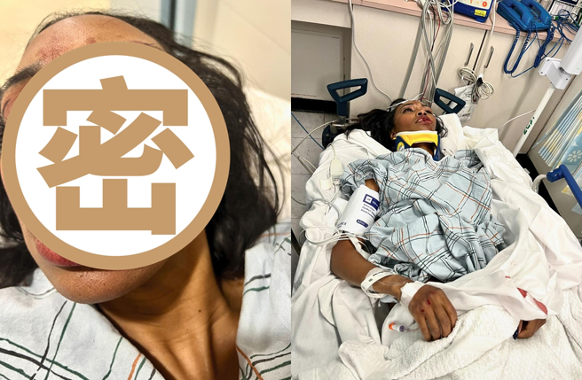 曾演过《黑豹》的特技女演员嘉莉伯南斯惨遭撞伤。（图／翻摄carriebernans Instagram）