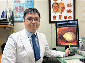 6旬男聲音沙啞一直好不了 檢查竟是罹患這癌症