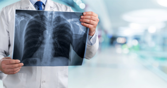 預防肺癌！專家推必吃6關鍵營養素 菠菜、堅果都入列