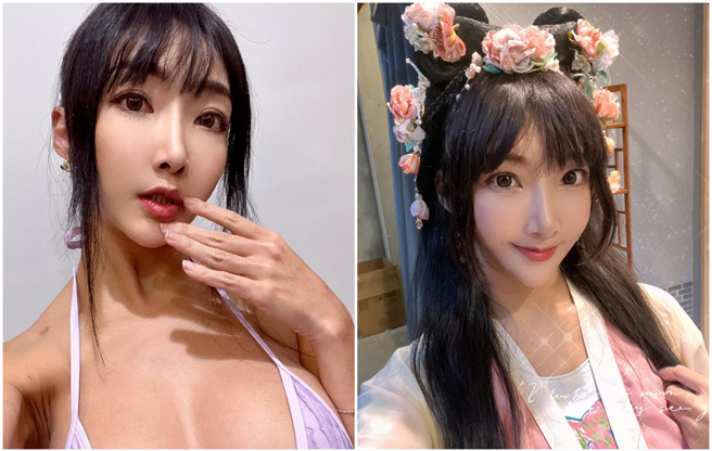 李宓分享术后成果。（图／脸书＠李宓）