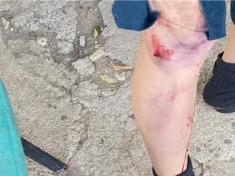 爬山突遭藏敖狂咬溅血 报案者也被扑倒 警追查竟无饲主！