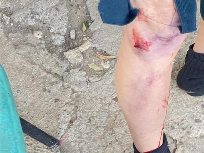 高雄寿山惊传登山客从龙泉寺登山口旁起登时，被一只疑似当地住户饲养的藏敖无预警扑倒攻击，膝盖当场溅血、腿部严重擦伤。（取自脸书社团「柴山志工奉茶队」／袁庭尧高雄传真）