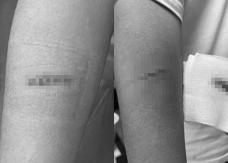 台南傳國中生持彈簧刀割同學 教育局給說明了