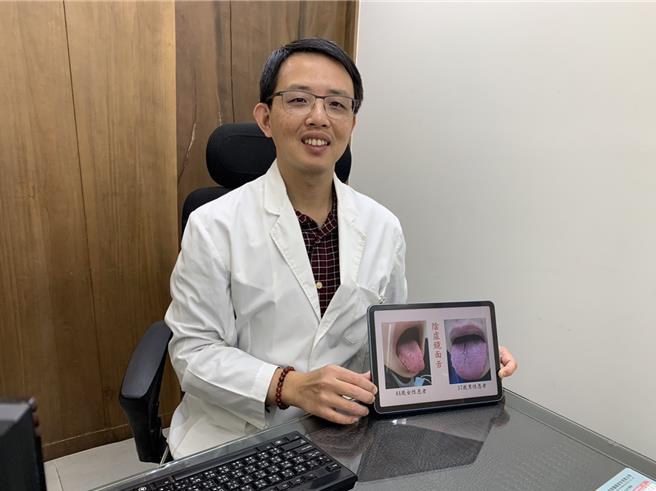 新竹市蔡宗璟中医诊所院长蔡宗璟表示，乾咳无痰，咳嗽连续难停止，且易口乾舌燥，甚至眼鼻都乾燥，是属于典型中医的「燥咳」。（陈育贤摄）