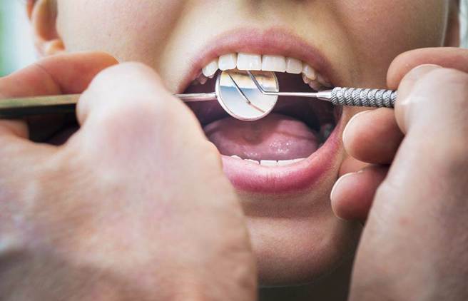 保持良好口腔衛生對於預防牙齒損害非常重要，但小心早上吃錯食物也會對牙齒造成負面影響。（示意圖／Shutterstock／達志）