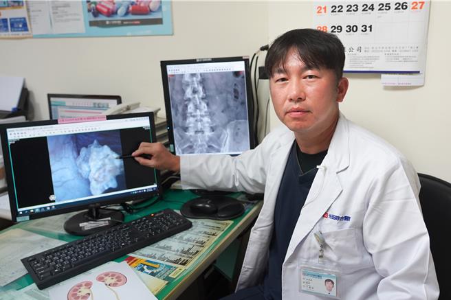 光田綜合醫院泌尿科醫師丁原田說，謝小姐腎臟結石，苦惱「震不碎」經建議施作可彎曲的「軟式輸尿管鏡」手術，將「頑石」取出，術後1個多月，發炎症狀消失，恢復良好。（光田綜合醫院提供／張妍溱台中傳真）