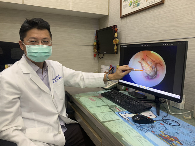 李瑞文醫師說明以內視鏡在婦人的右耳裡發現一隻蟑螂。記者吳慧芬／攝影