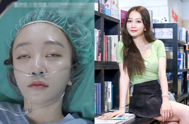女星筱崎泫日前公开动手术前的麻醉影片。（图／中时资料照、翻摄hsyan0625 Instagram）